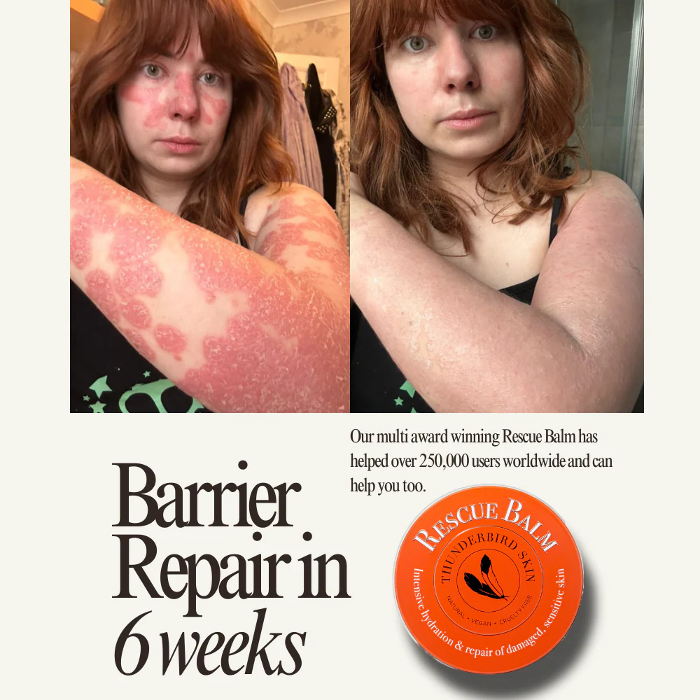 Rescue Balm - Image 10