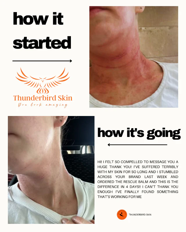 Rescue Balm - Image 11