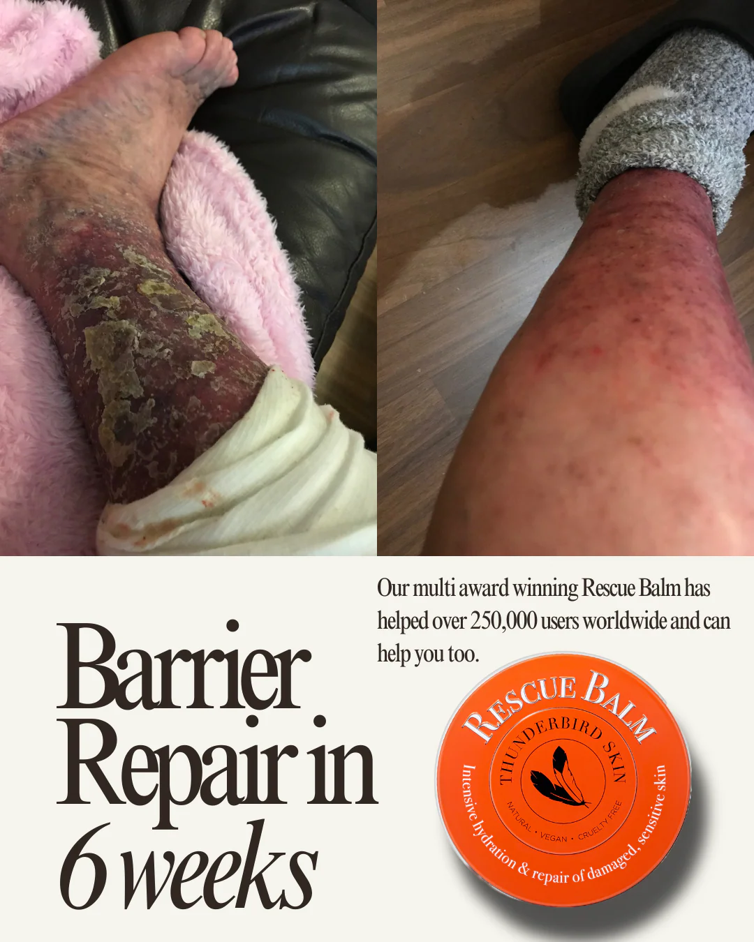 Rescue Balm - Image 12