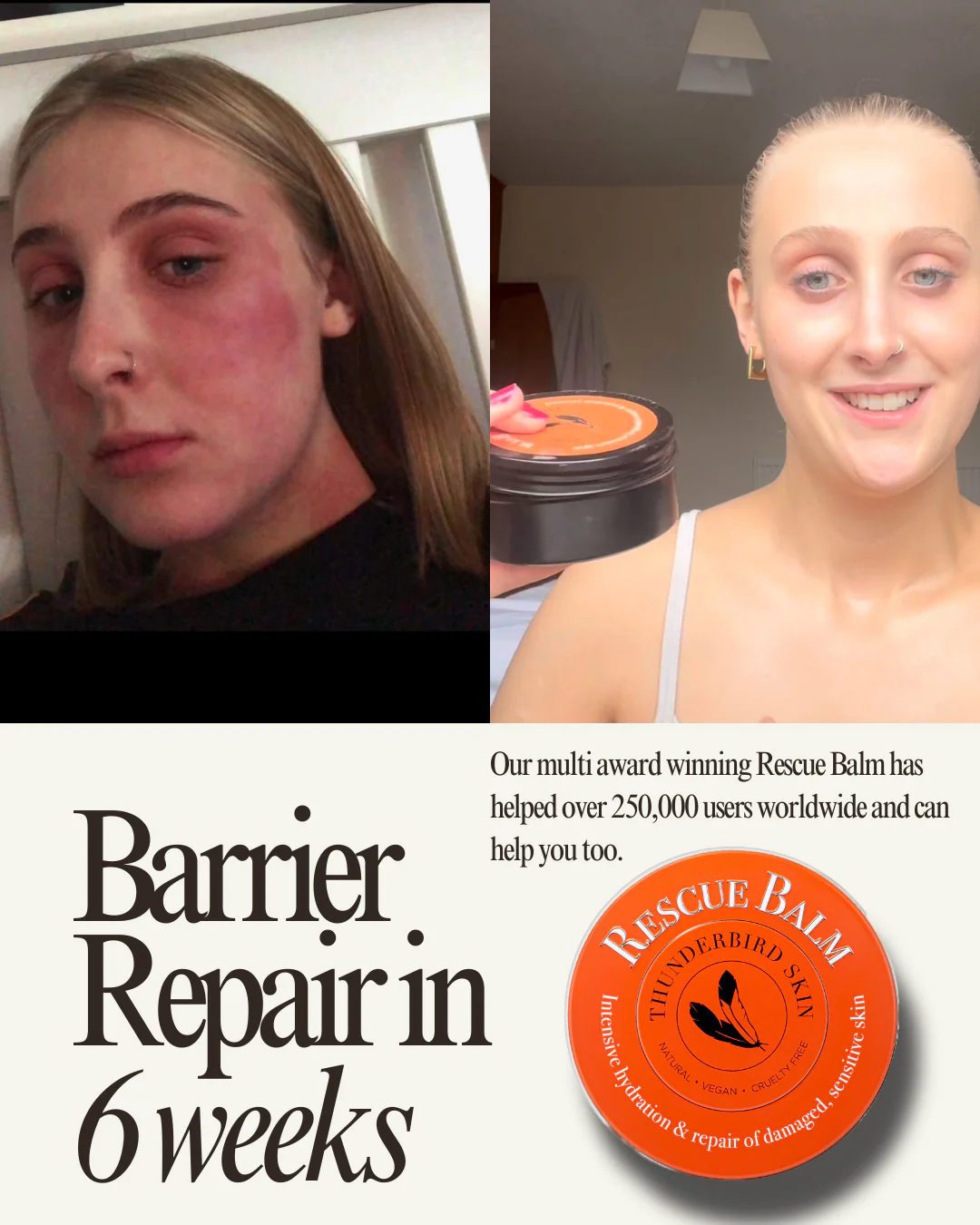 Rescue Balm - Image 14