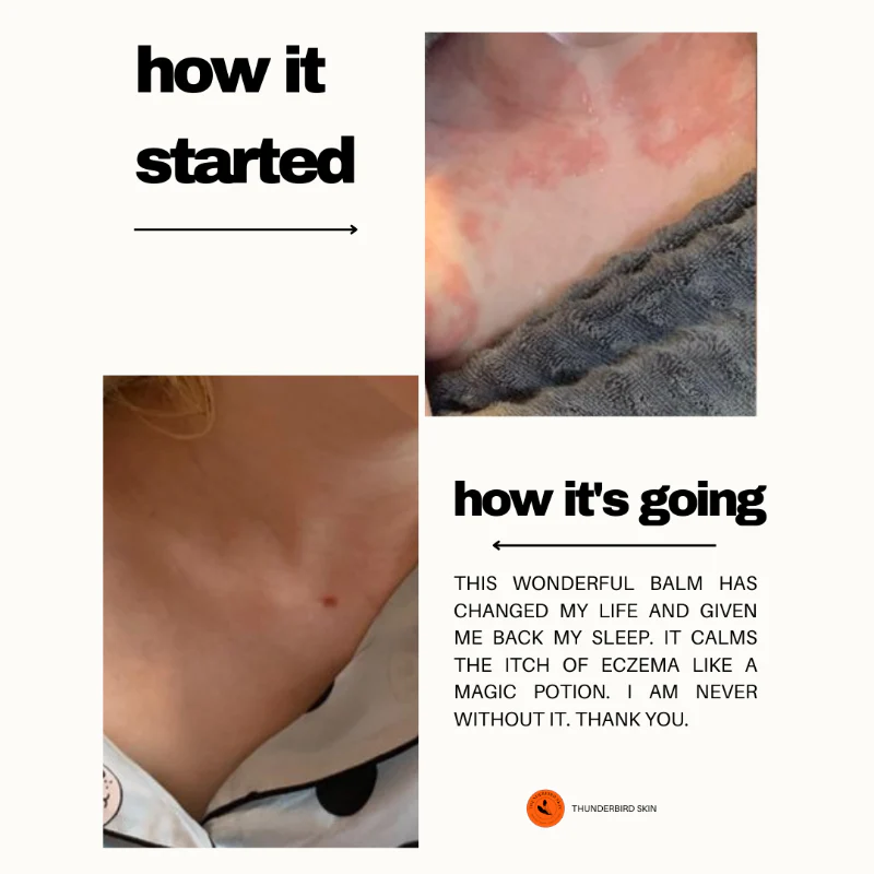 Rescue Balm - Image 17