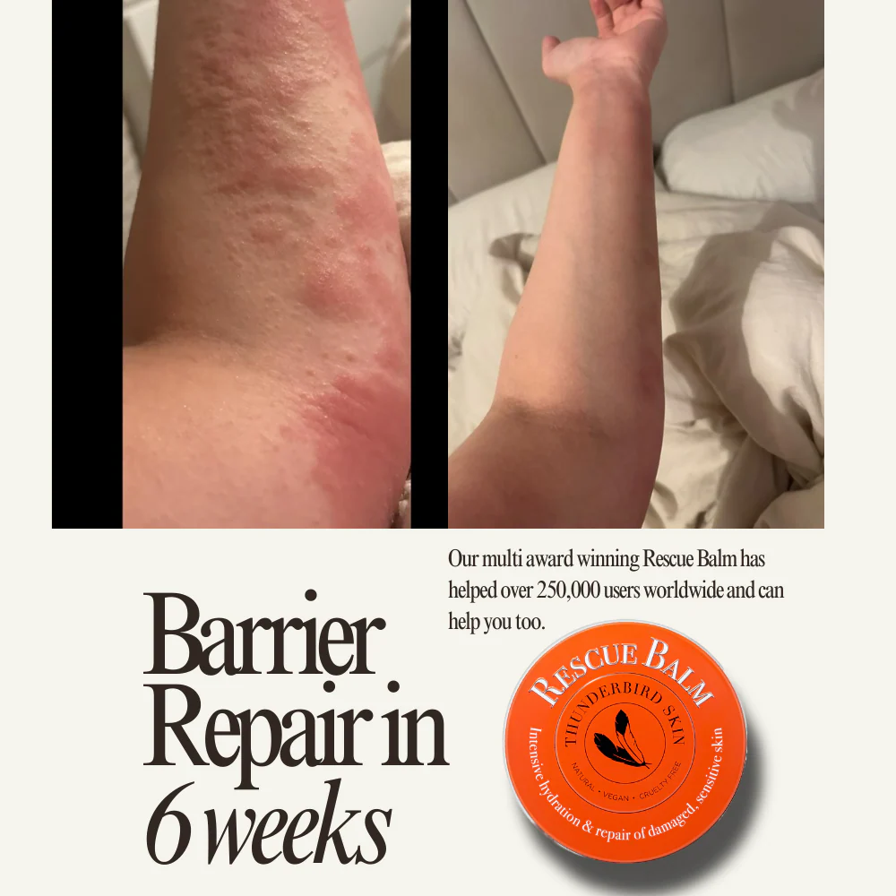 Rescue Balm - Image 18