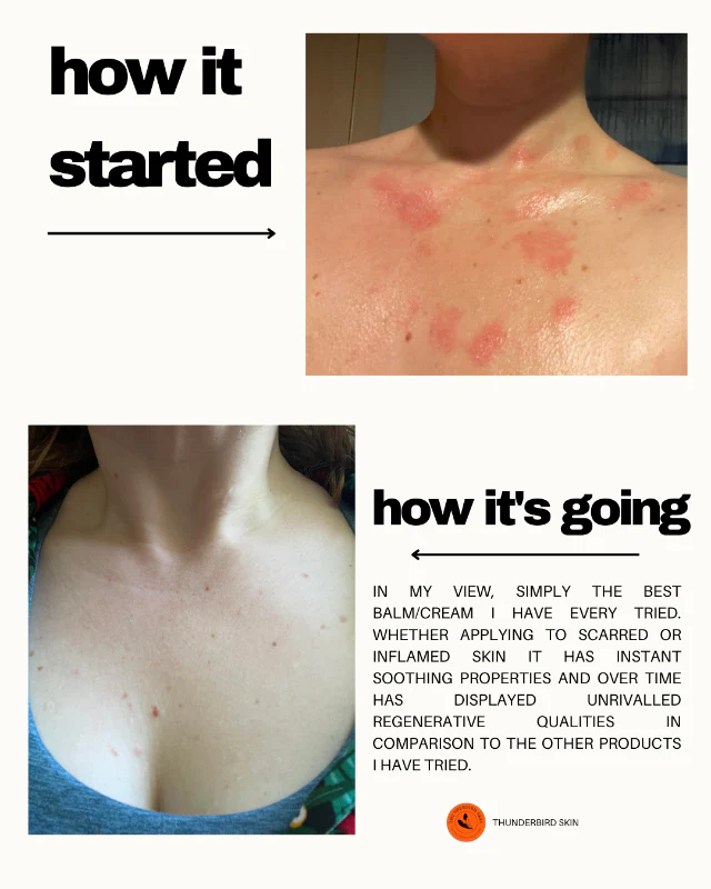 Rescue Balm - Image 19