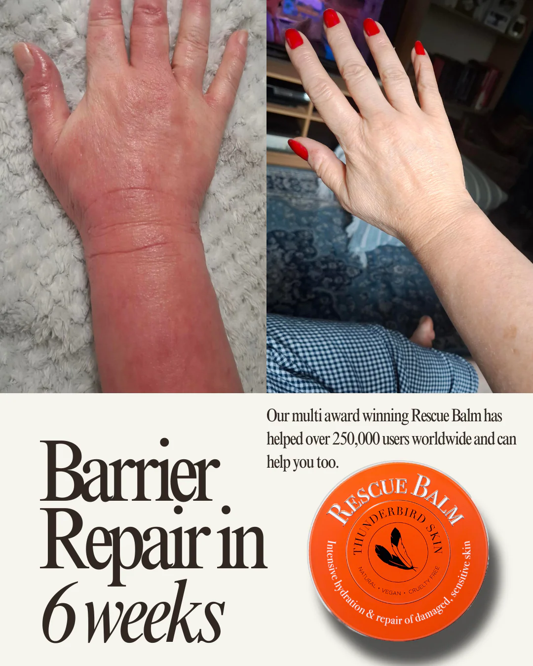 Rescue Balm - Image 22