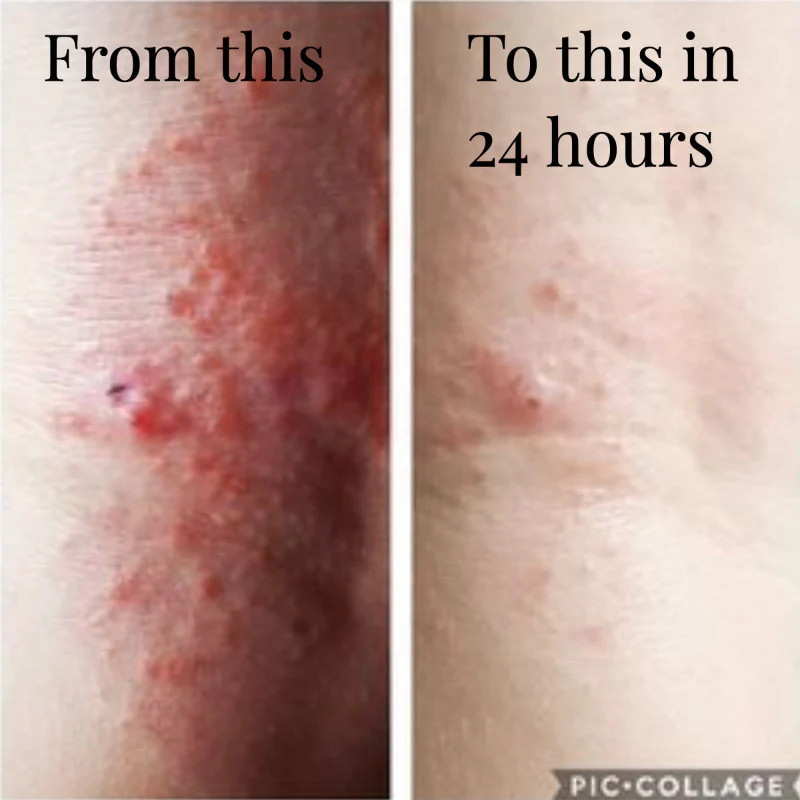 Rescue Balm - Image 23