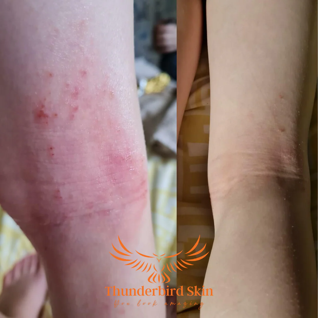 Rescue Balm - Image 25