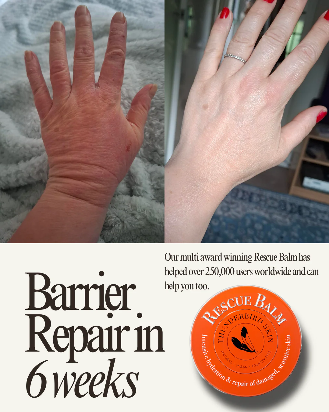 Rescue Balm - Image 28