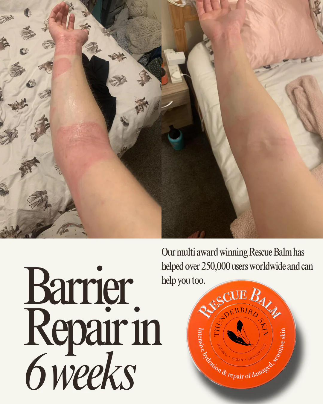 Rescue Balm - Image 29