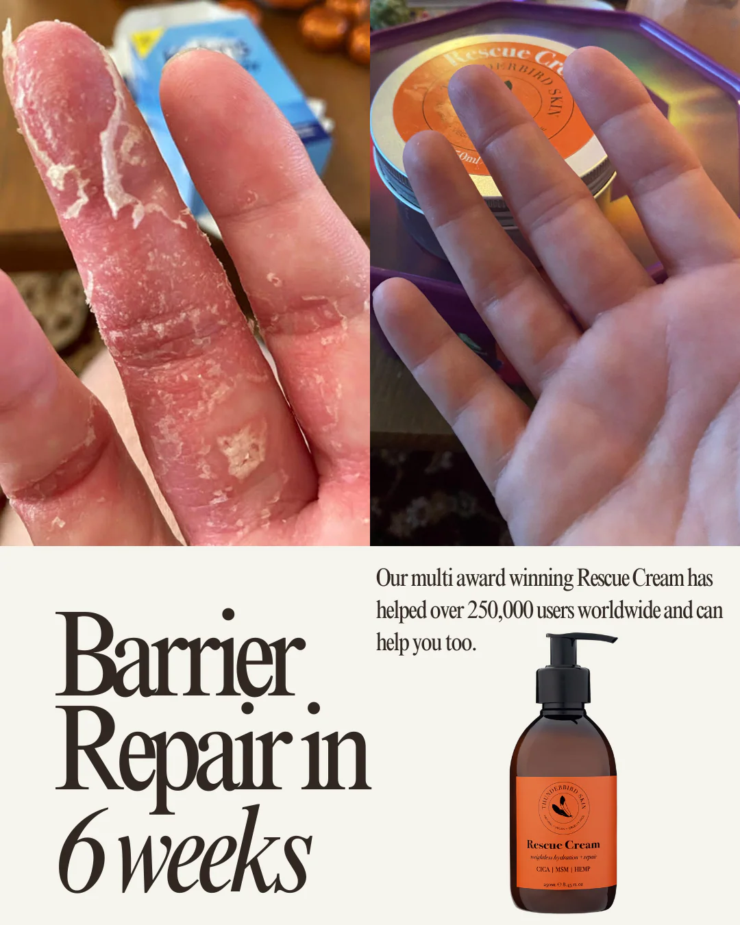 Rescue Cream - Image 6