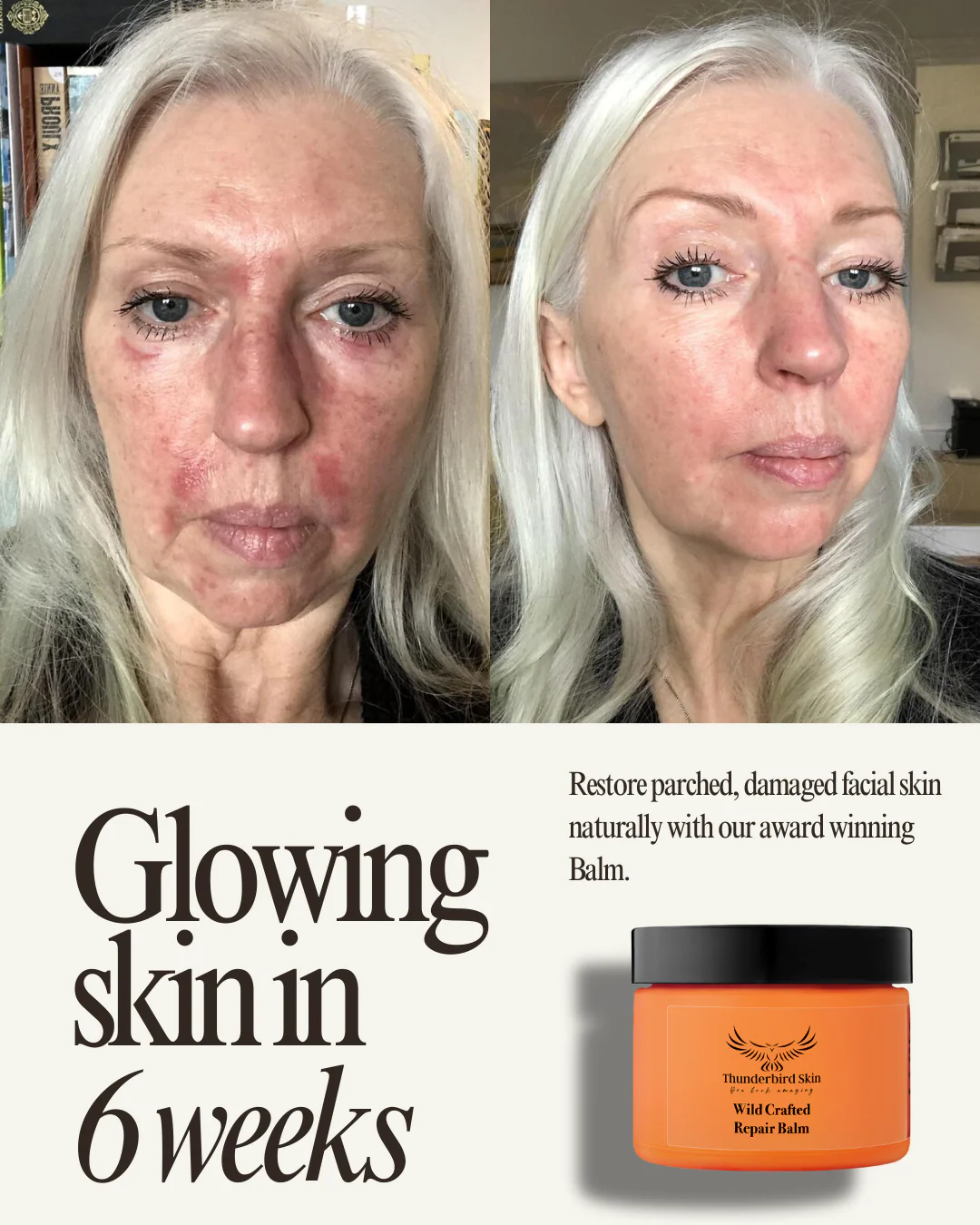 Wild Crafted Repair Balm - Image 10