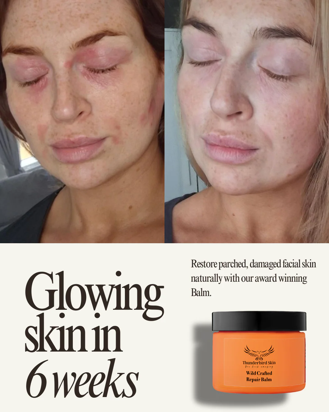 Wild Crafted Repair Balm - Image 13