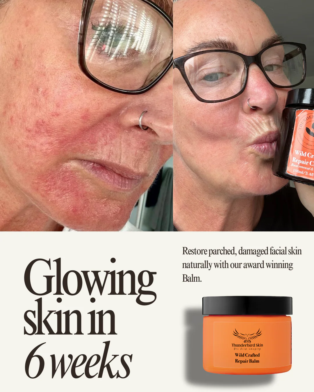Wild Crafted Repair Balm - Image 14
