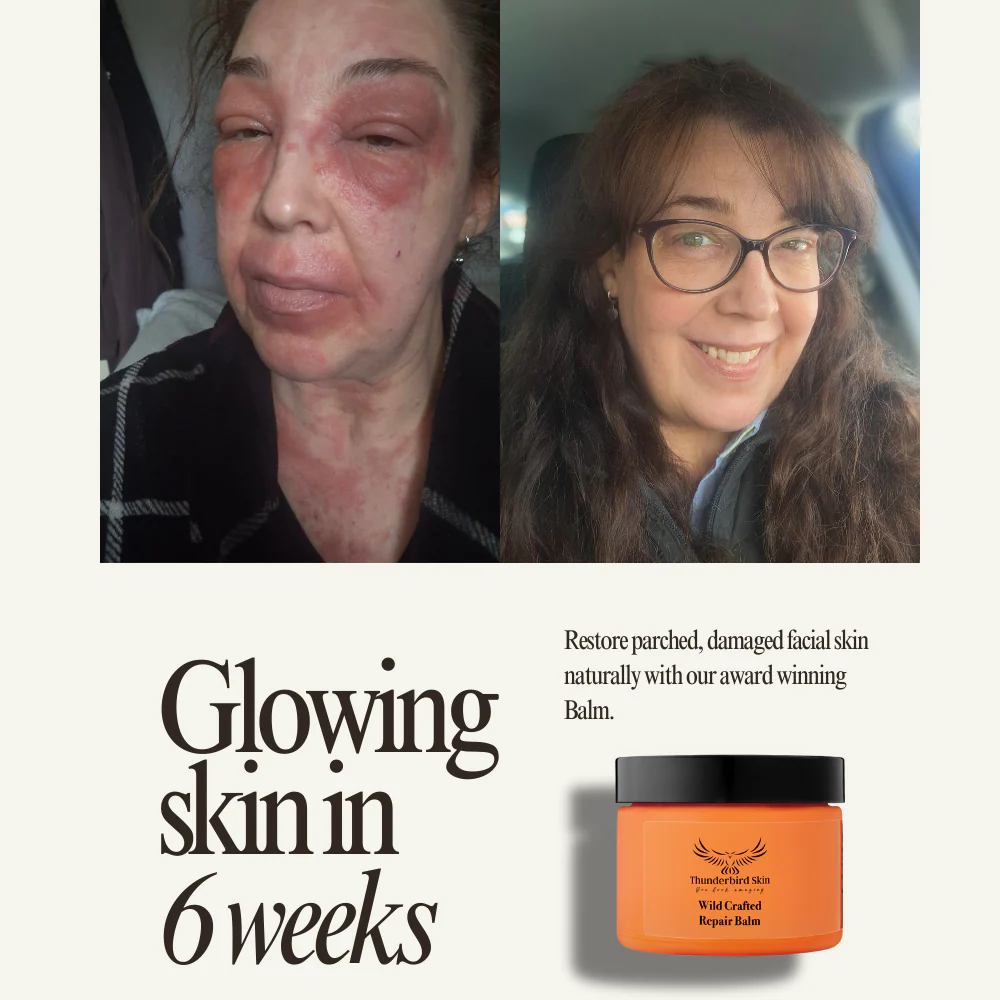 Wild Crafted Repair Balm - Image 9